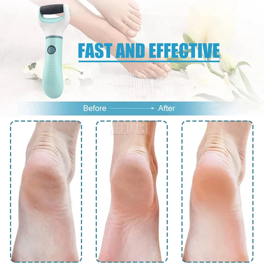 Electric Foot Grinder - Wireless Pedicure Tool for Dead Skin, Calluses, and Cracks